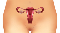 Female Ovaries With PCOS