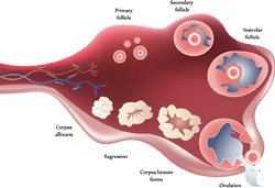Polycystic Ovary Illustration