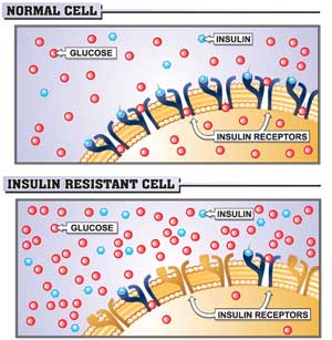 Insulin Resistant Cell