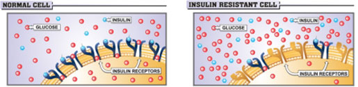 Normal vs. Insulin Resistant Cell
